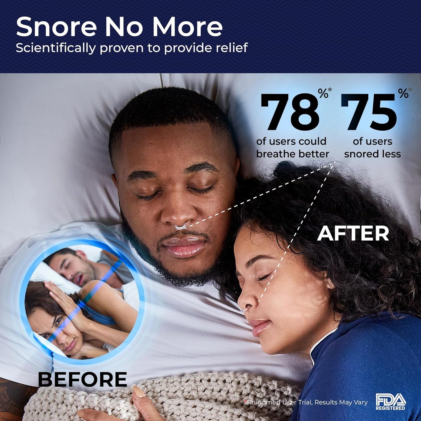 MUTE by  Nasal Dilator for Snore Reduction | Small 3Pk | Increase Airflow | anti Snoring Devices | Nasal Dilators for Sleeping | Internal Nasal Dilator | Snoring Solution | Transparent