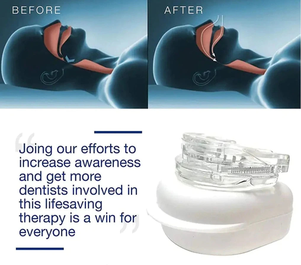 Anti-Snoring Mouthpiece